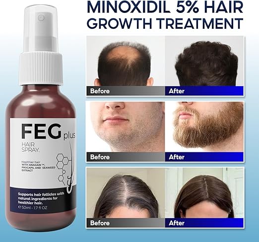 Hair Growth Spray