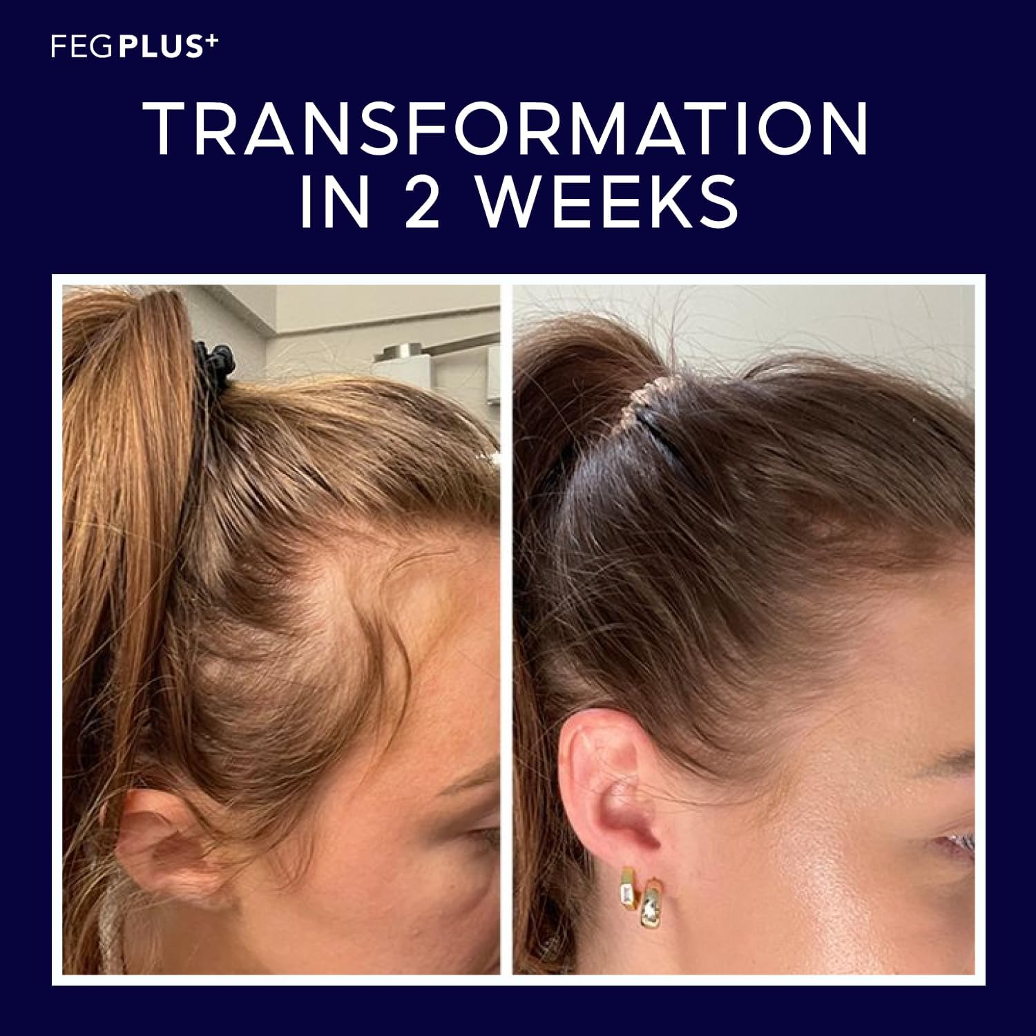 Hair Growth Spray